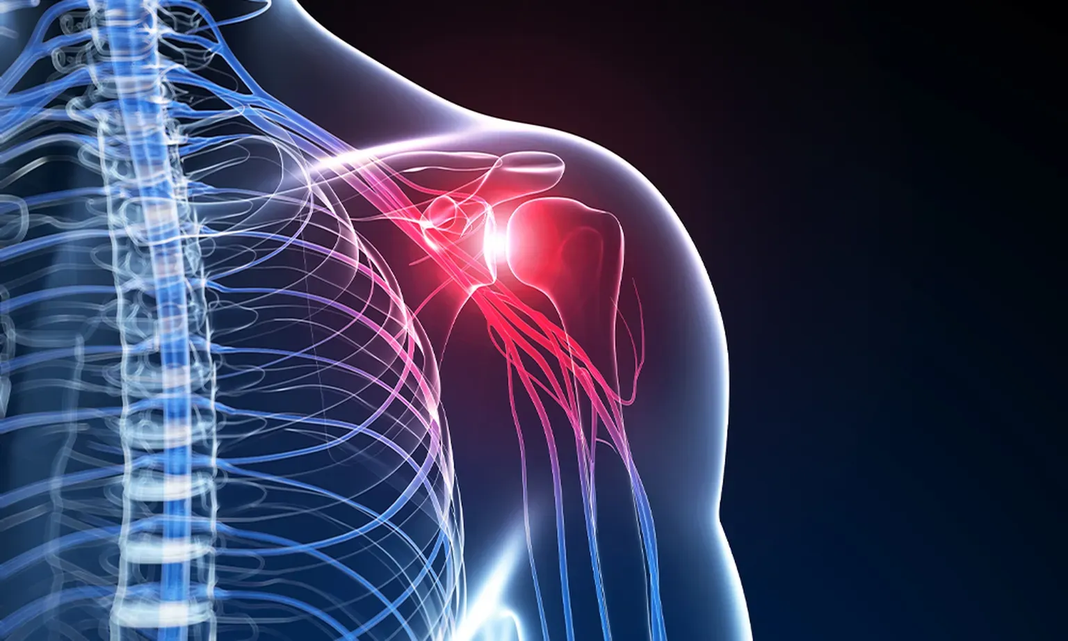 Labral Tear in Newton NJ
